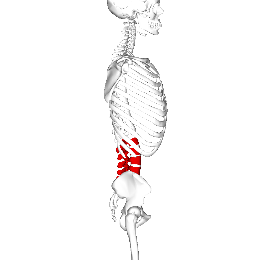 Laminectomy for lumbar spinal stenosis