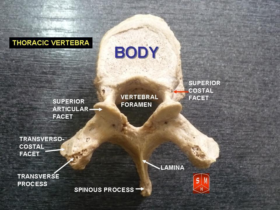 Sciatica: leg pain that starts in the lumbar spine