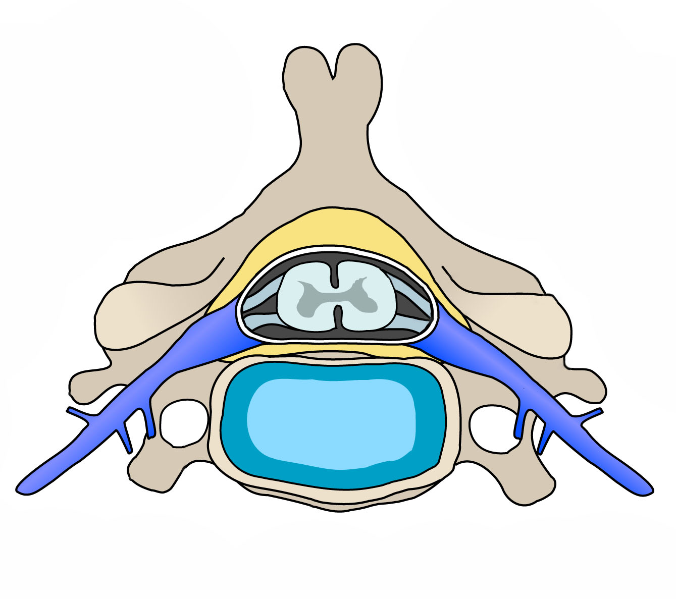 Understanding Cervical Sarcopenia and Its Impact on Outcomes
