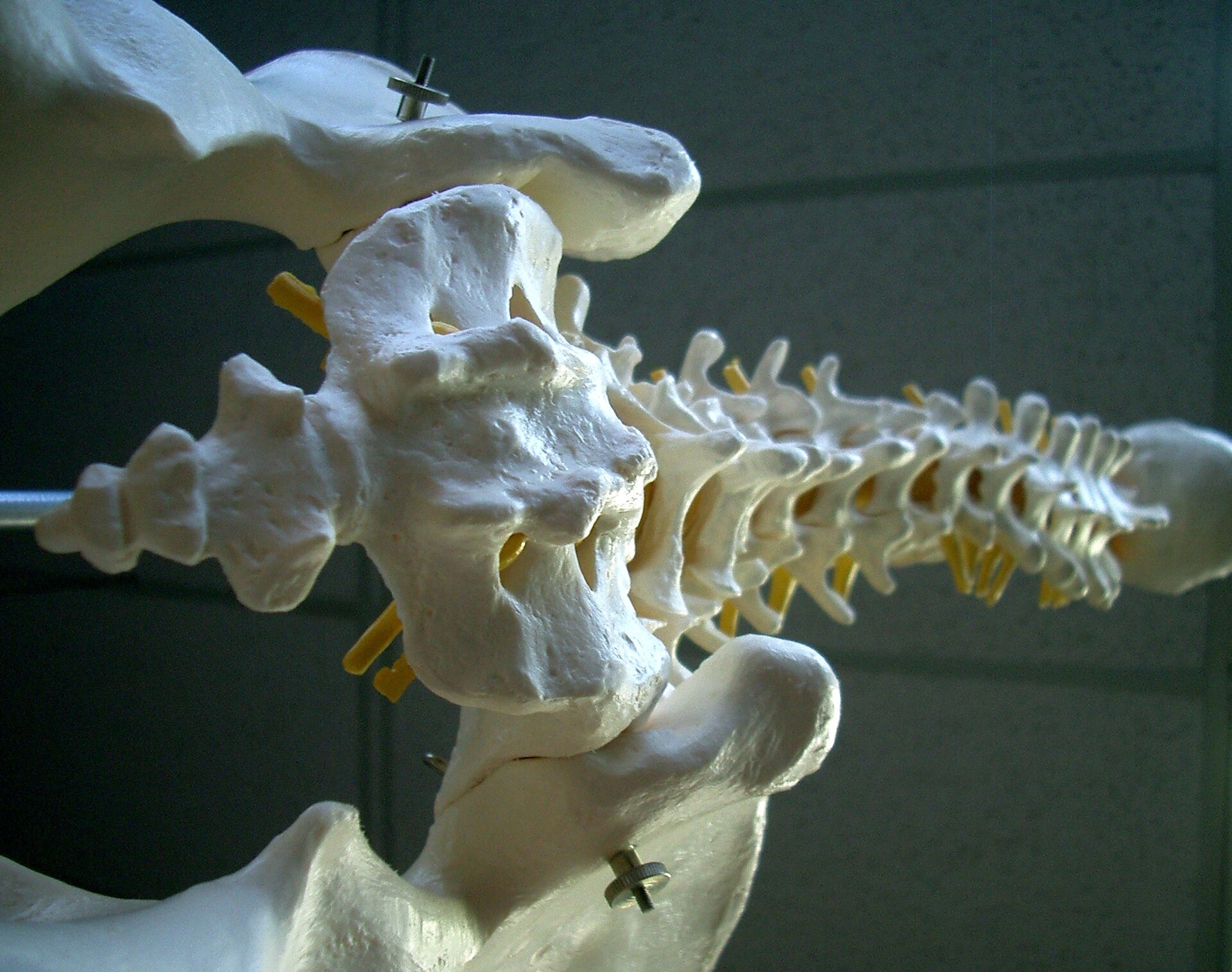 Wearable Technology in Spine Recovery: Insights from The Alignment Clinic